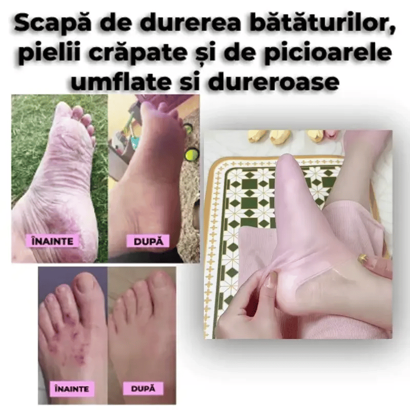 Șosete reutilizabile pentru Hidratarea Picioarelor - PediFix™